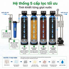 Bộ lọc tổng đầu nguồn Kangaroo KG1054LT-5 - 5 cấp lọc