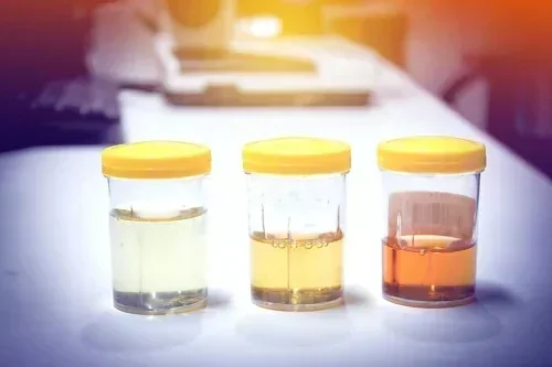 Ảnh test nước sinh hoạt có màu để tư vấn lọc tổng